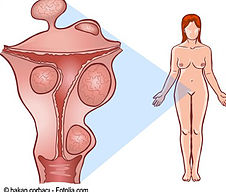Clínica de Laparoscopía Ginecológica - Tijuana Ginecologist/Ginecologia Tijuana, Dr. Daniel Sánchez, ginecologos, laparoscopy, infertilidad, infertility, ginecology