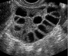Clínica de Laparoscopía Ginecológica - Tijuana Ginecologist/Ginecologia Tijuana, Dr. Daniel Sánchez, ginecologos, laparoscopy, infertilidad, infertility, ginecology