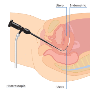 Clínica de Laparoscopía Ginecológica - Tijuana Ginecologist/Ginecologia Tijuana, Dr. Daniel Sánchez, ginecologos, laparoscopy, infertilidad, infertility, ginecology